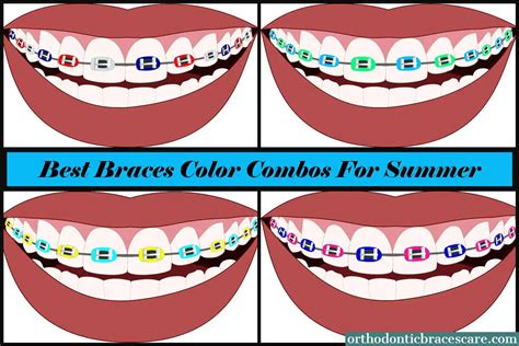 good braces color combinations.